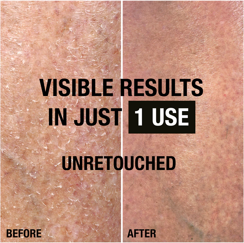 Neutrogena Norwegian Formula® Intensief Regenererende Bodymelk voor de droge huid