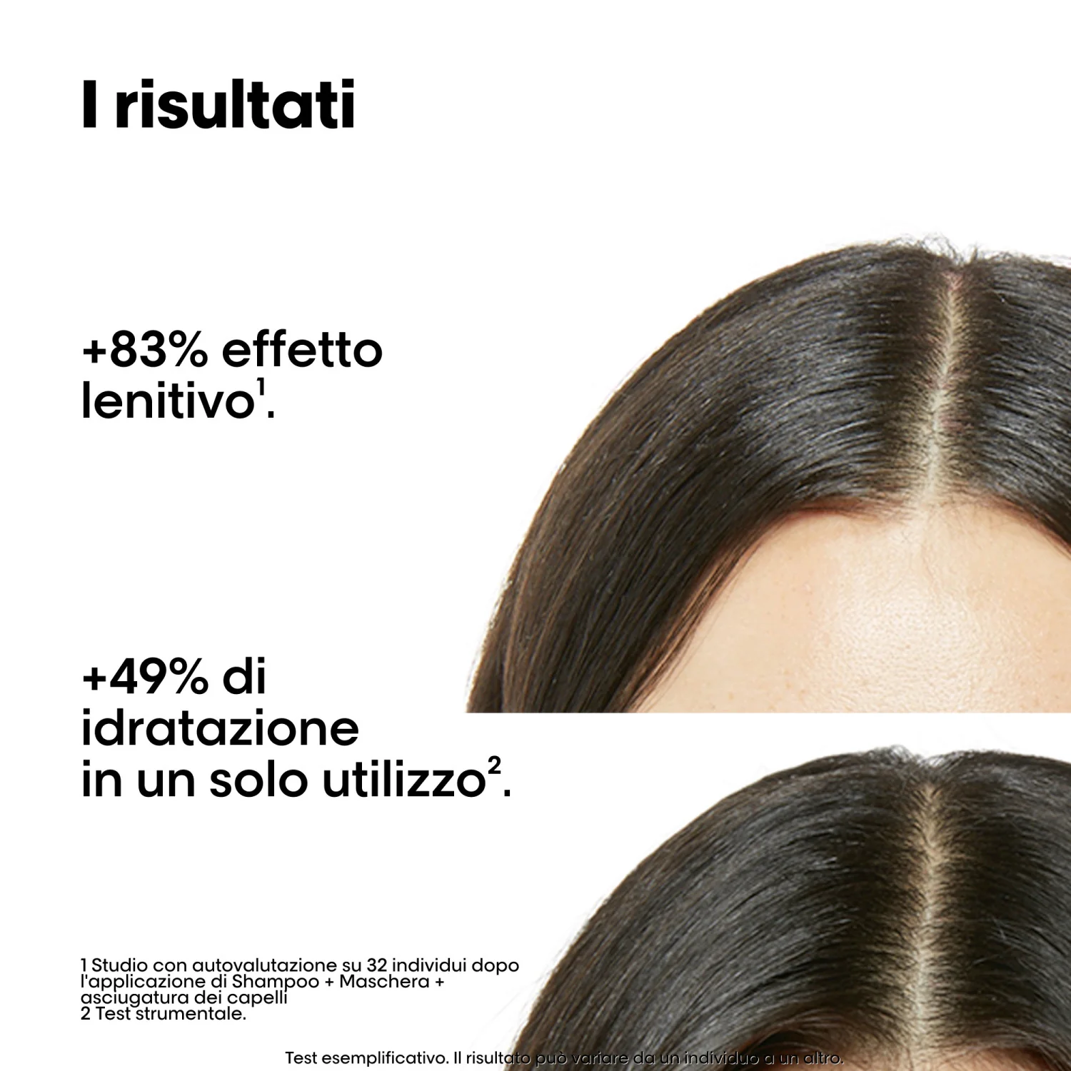 SERIE EXPERT New Cofanetto Natale Scalp Advanced Anti-Discomfort Duo - Cofanetti per Capelli