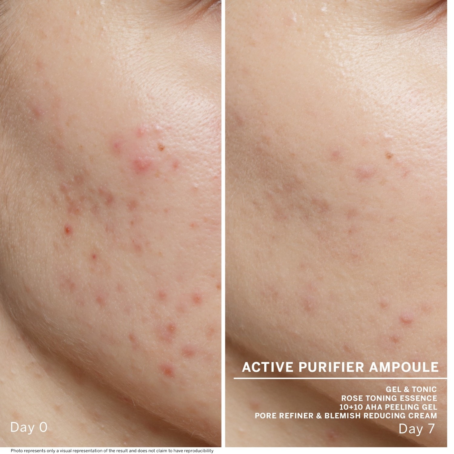 BABOR Ampoule Serum Ampoule Concentrate Active Cleanser -puhdistusaine - 14 ml