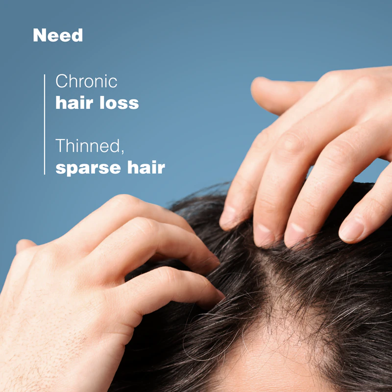 Ducray Anaphase+ Shampoo tegen haaruitval en dunner wordend haar
