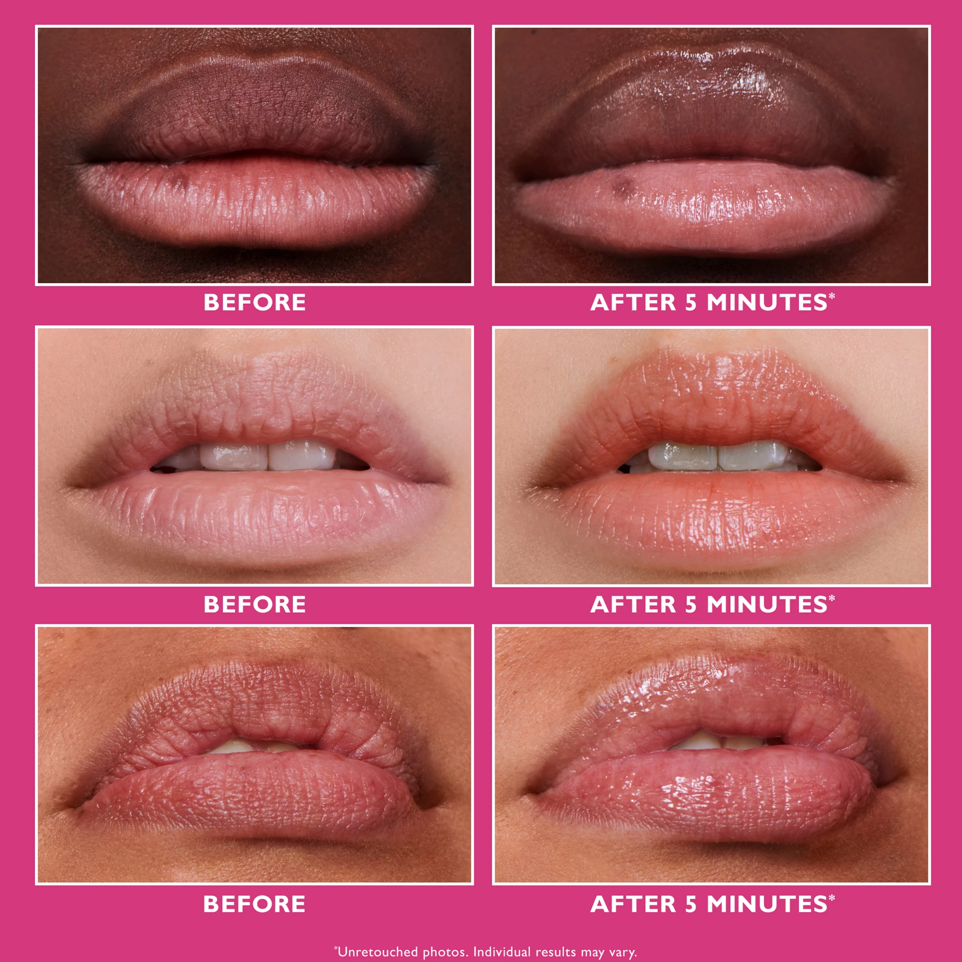 Umplere de buze instant FIRMx® 10 ml - Peter Thomas Roth