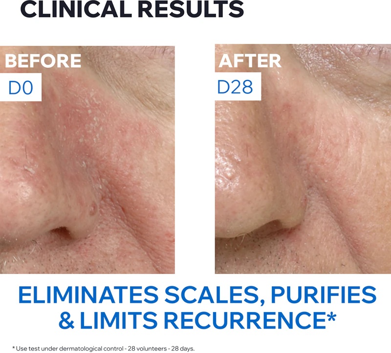 Uriage DS regulirajoča pomirjujoča emulzija za penetracijo.