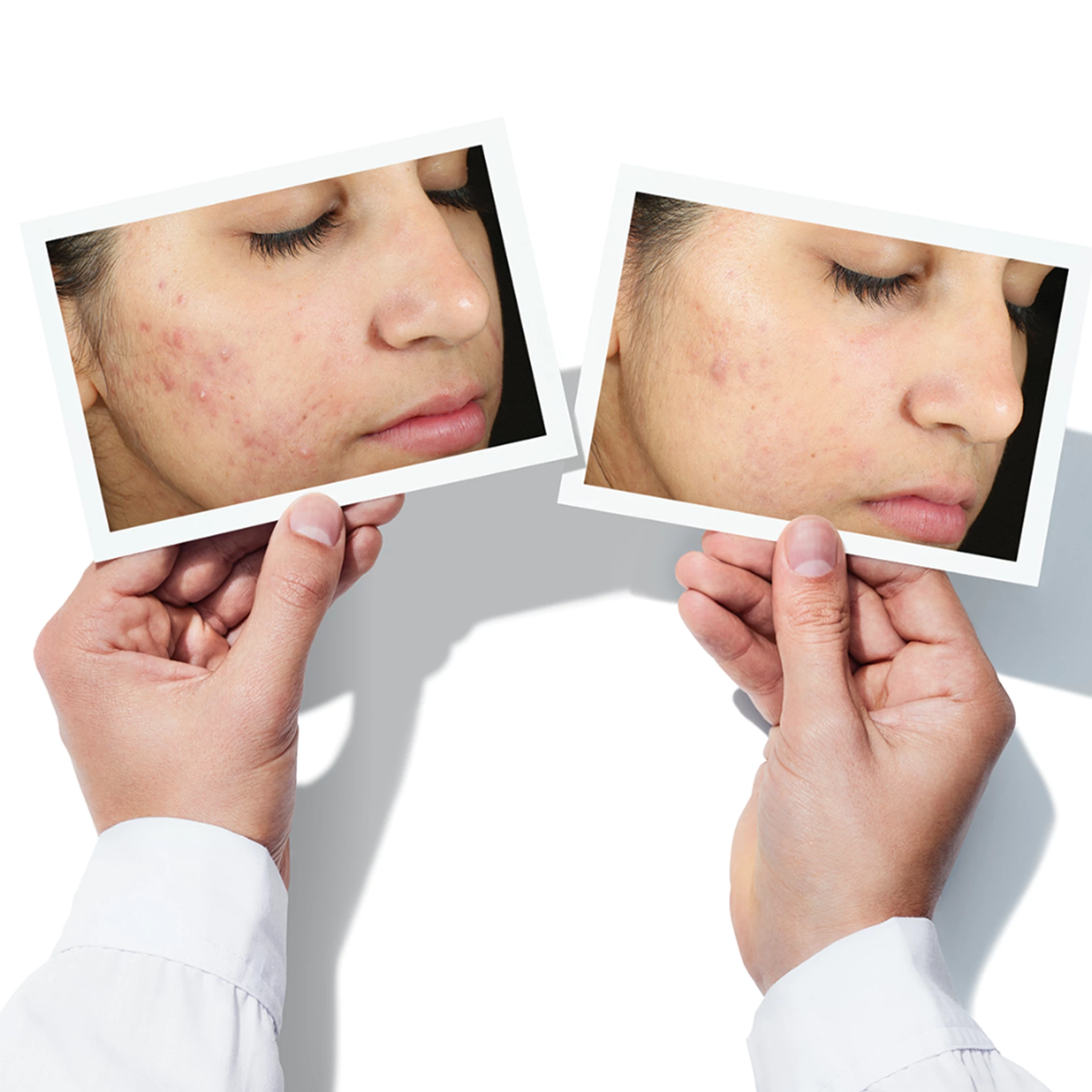 Invisiscar bőrfiatalító kezelés 15 ml - Murad