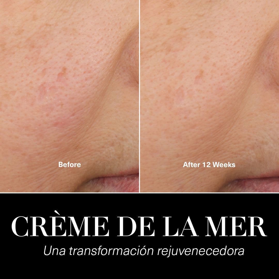 Hydratačný krém Crème de la Mer Luxusné hydratačné a výživné zložky