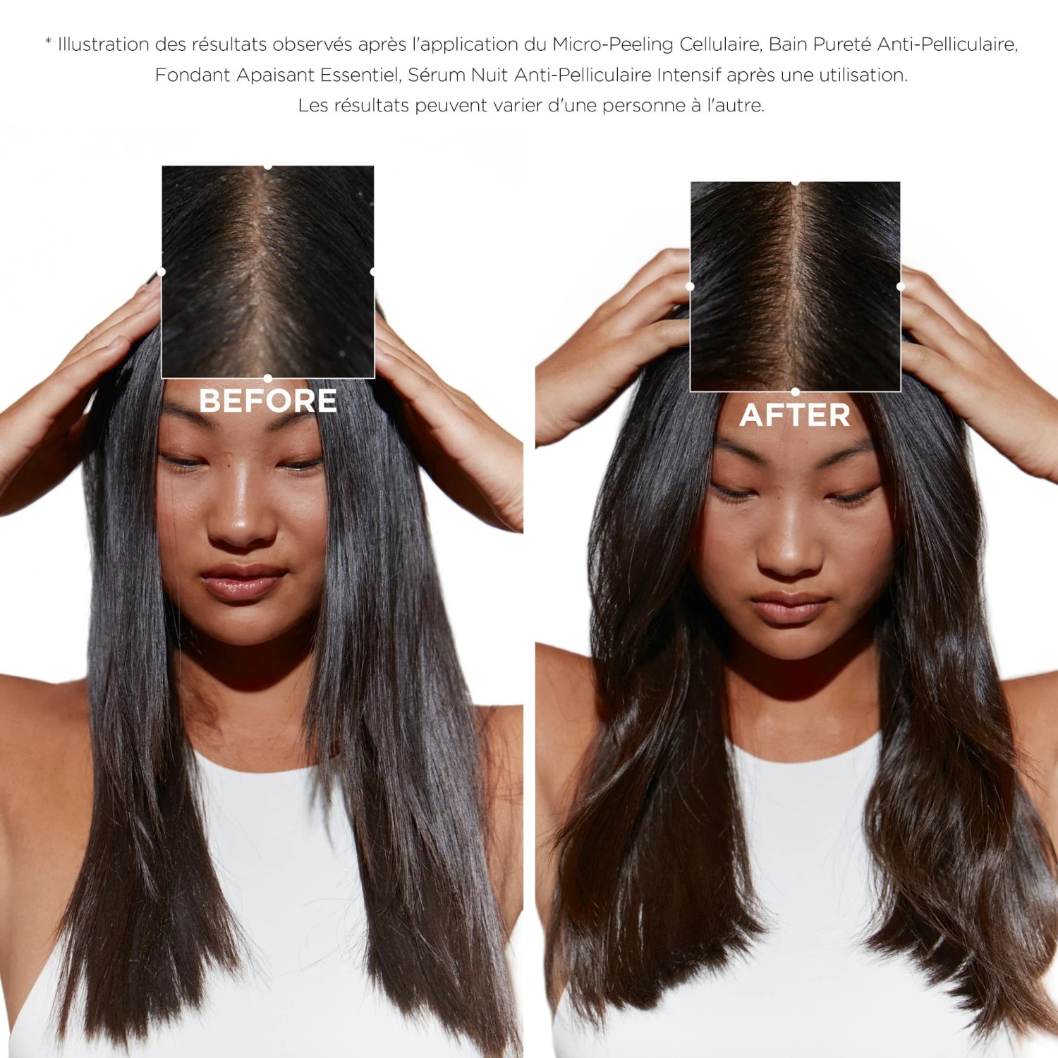 Kérastase Micro-Peeling Cellulaire
