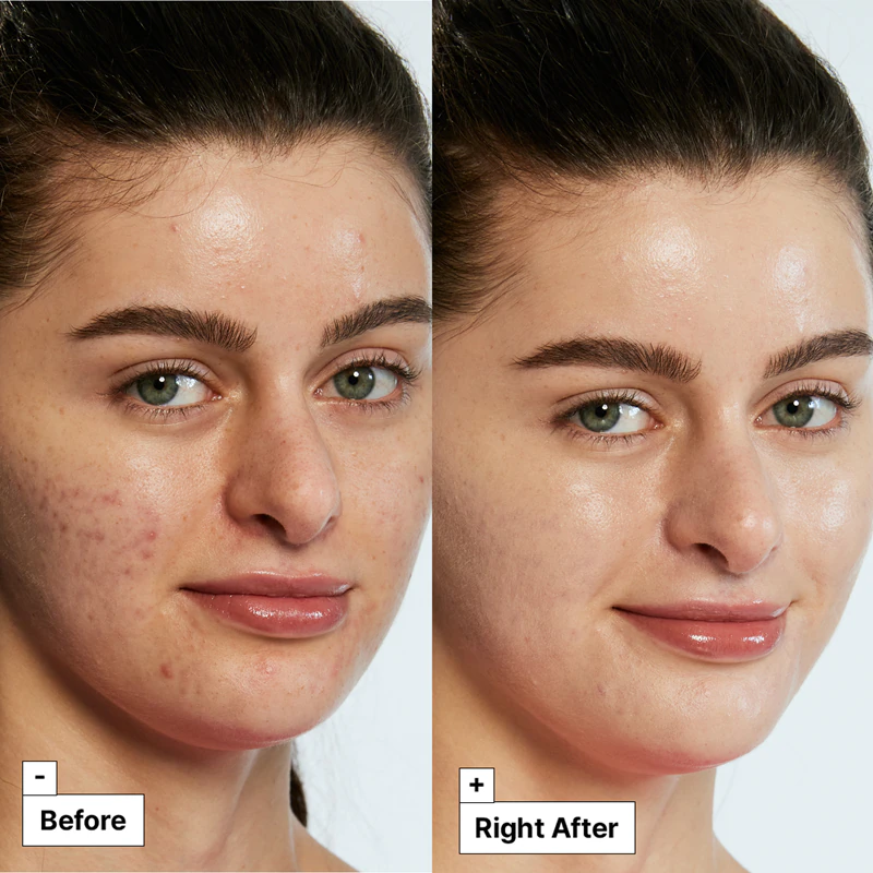creme de tratamento corretor de cor Dr. Jart+ Cicapair™ Tiger Grass reduz intensamente a vermelhidão.