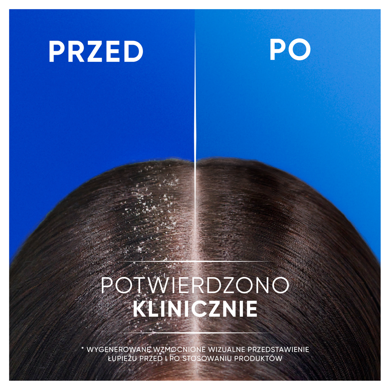Head&Shoulders Classic Clean