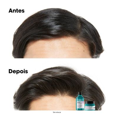 L'Oréal Professionnel Serie Expert Scalp Advanced Anti-Gras Shampoo Rauhoittava Hilsettä Vastustava Shampoo Kuiville Ja Rasvoittuville Hiuksille 500 ml