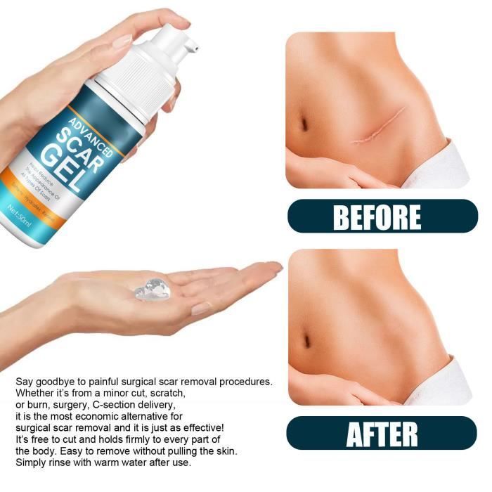 Crème Cicatricielle Crème Anti-Cicatrices Gel Réparateur Pour Les Cicatrices De La Peau Douce Et Non Grasse Pour Les 45398