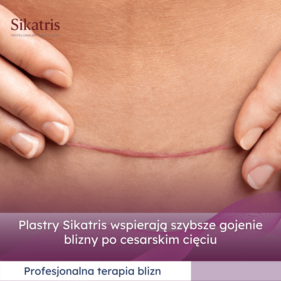 Biovena Sikatris