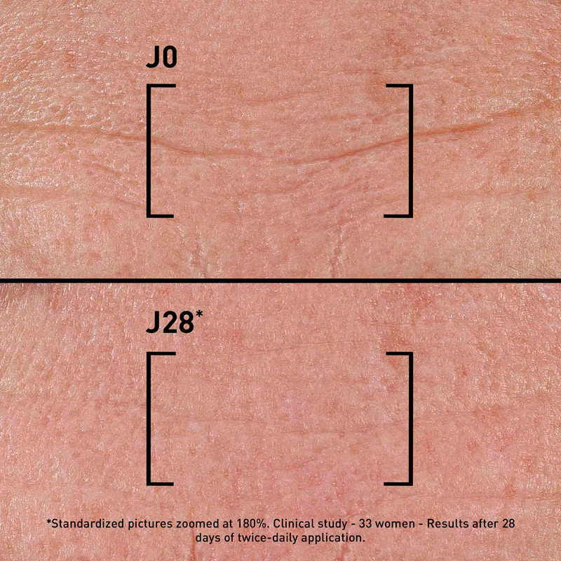 FILORGA TIME-FILLER INTENSIVE 5XP intensief anti-rimpelserum