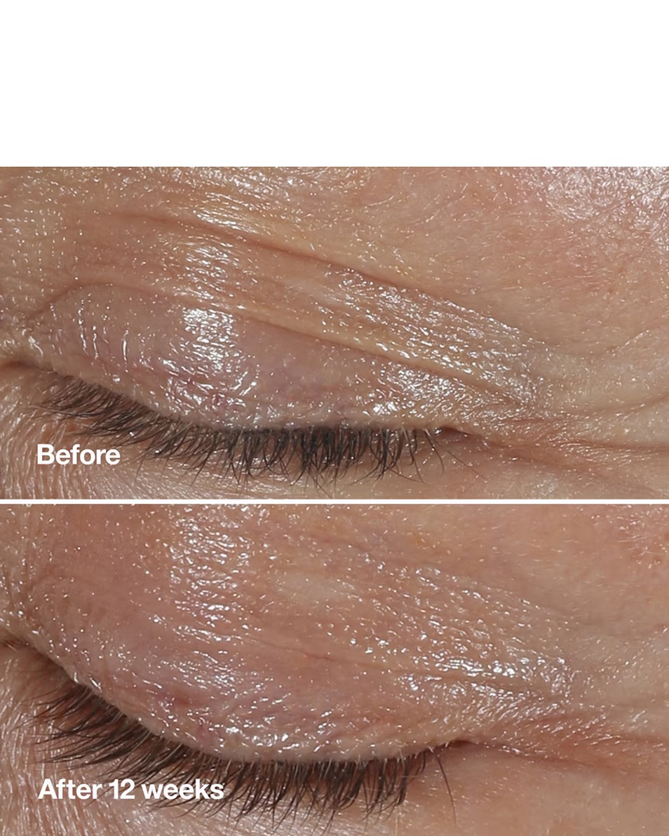 CLINIQUE SMART CLINICAL REPAIR™ KREMA ZA ISPRAVLJANJE BORA ZA OČI KREMA ZA OČI - PROTIV STARENJA I HIDRATANTNA - SMANJUJE BORE