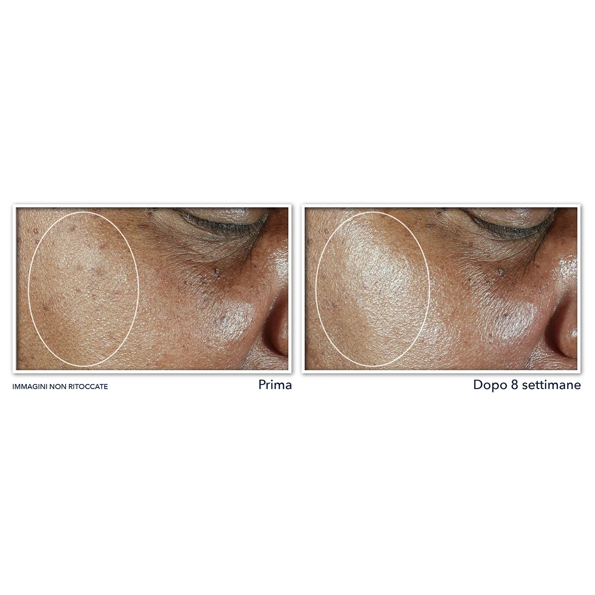 Multi Correxion Even Tone + Lift Idratante Viso con SPF30 - Crema viso giorno lifting, Crema viso giorno idratante, Crema viso giorno antimacchie, Crema viso giorno illuminante
