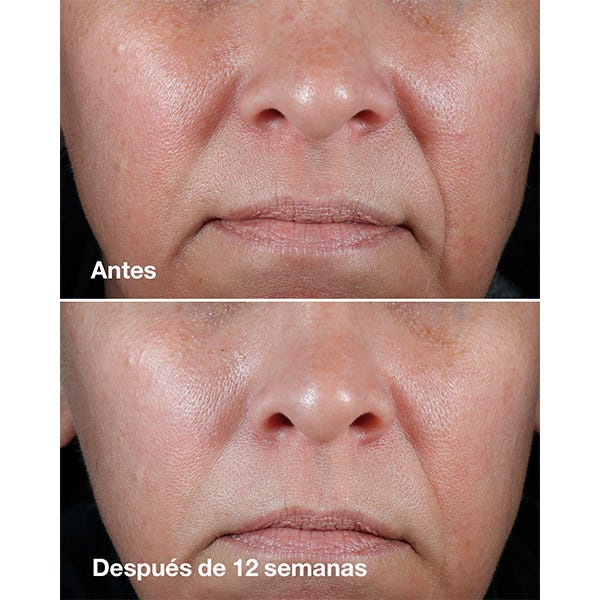 Cremă bogată Smart Clinical Repair | 50 ml