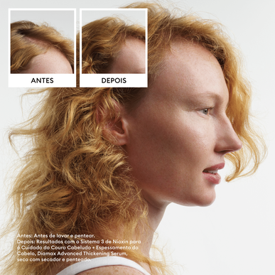 Nioxin Professionals Pack 1 Scalp Hair Natural Non Treated Hair Coffret Cabelo Tratamento Cabelo Natural 1 un 1 un
