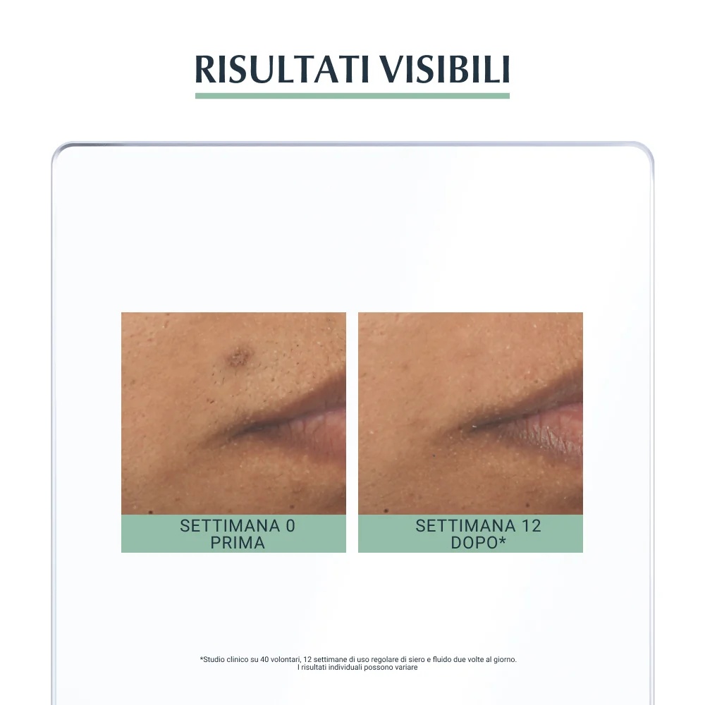 EUCERIN Eucerin DermoPurifyer Sérum Triple Action Contrôle du Sébum 40 ml pour peaux impures
