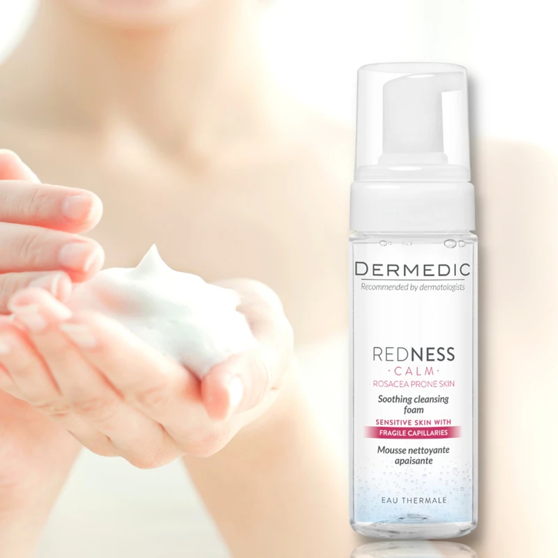 „Dermedic Redness Calm“ raminamosios valomosios putos