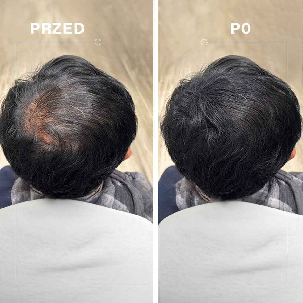 The Cosmetic Republic Keratinfibre