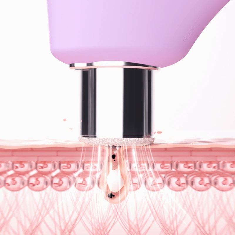 FOREO KIWI™ Derma ierīce dimanta mikrodermabrāzijai un dziļai sejas attīrīšanai