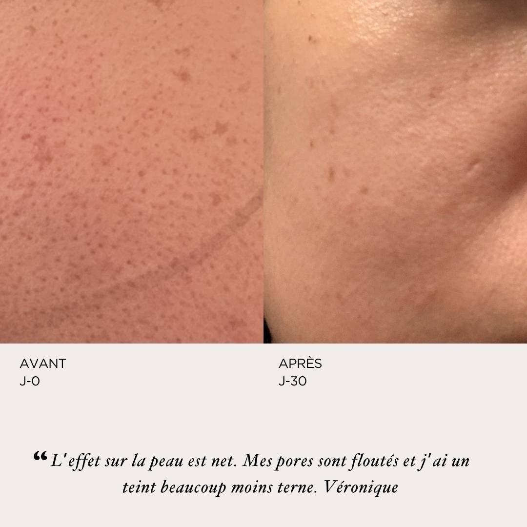 ORYZA LAB Peeling perfecteur - format voyage
