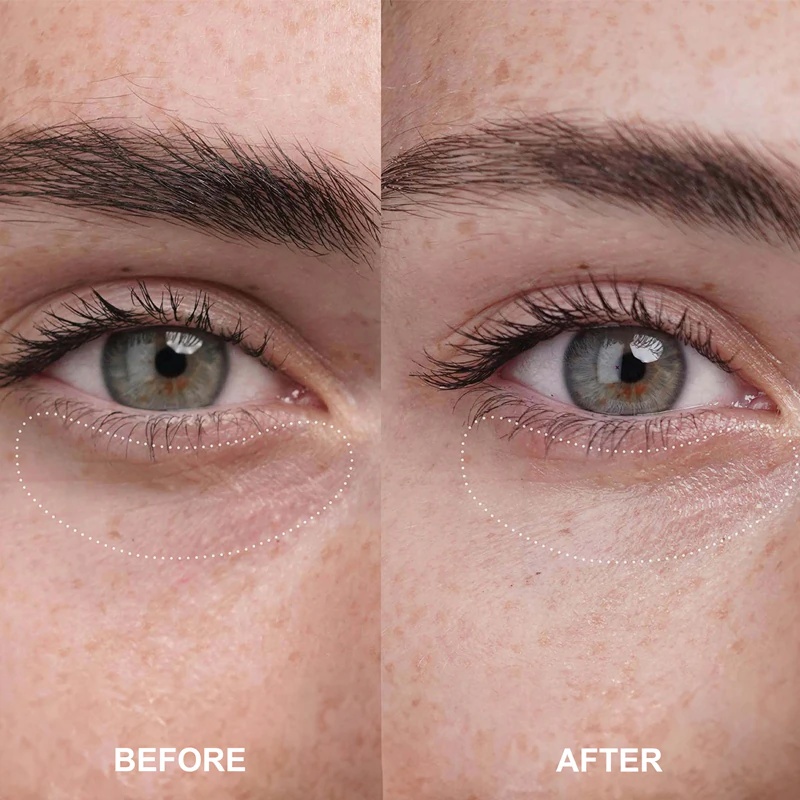 OLEHENRIKSEN Truth Banana Bright+ Eye Crème posvetlitvena krema za oči