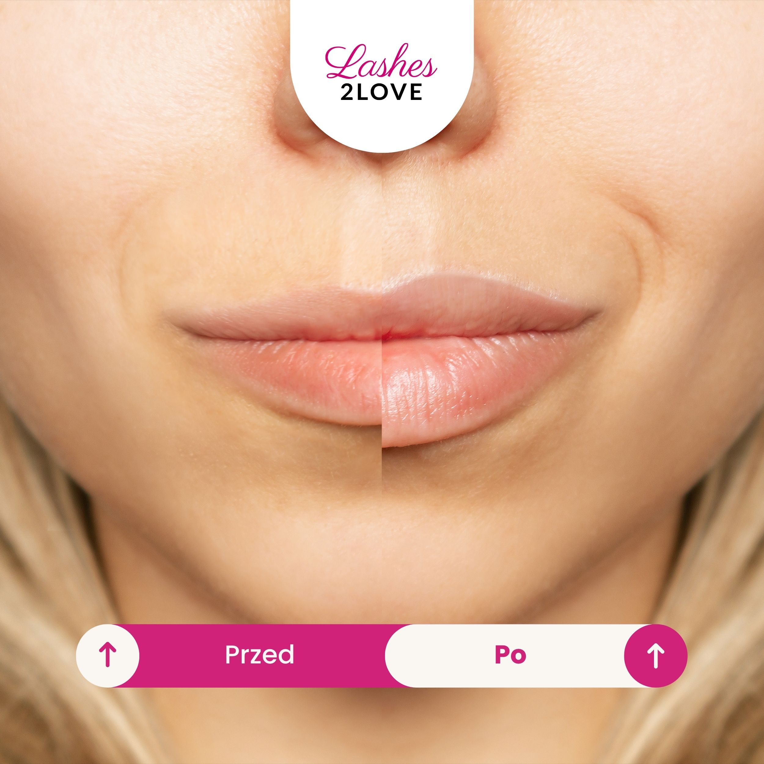 Inveo Lips2Love