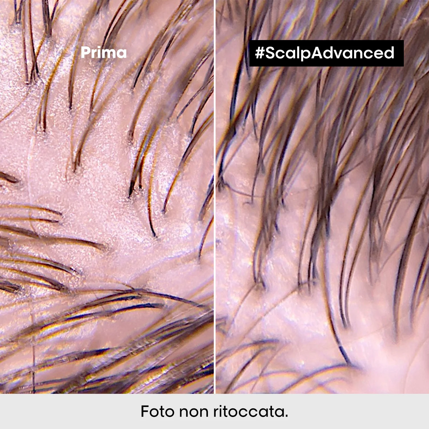 SERIE EXPERT New Scalp Advanced 2-in-1 Deep Purifier Clay Anti-Oiliness - Maschera Purificante Capelli, Shampoo Purificante