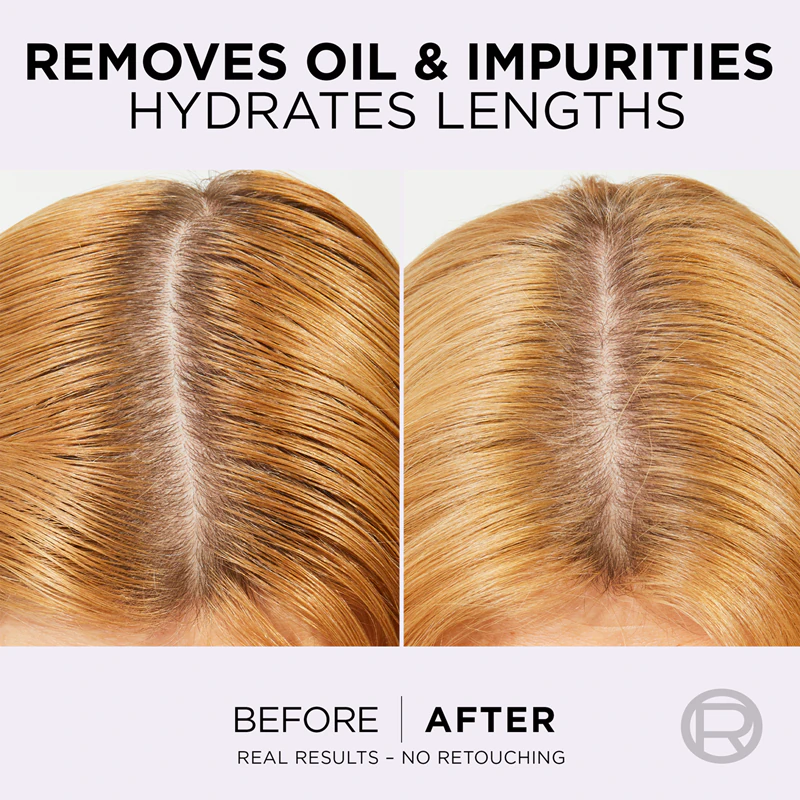 Shampoo hidratante L'Oréal Paris Elseve Hyaluron Pure para couro cabeludo oleoso e pontas secas.