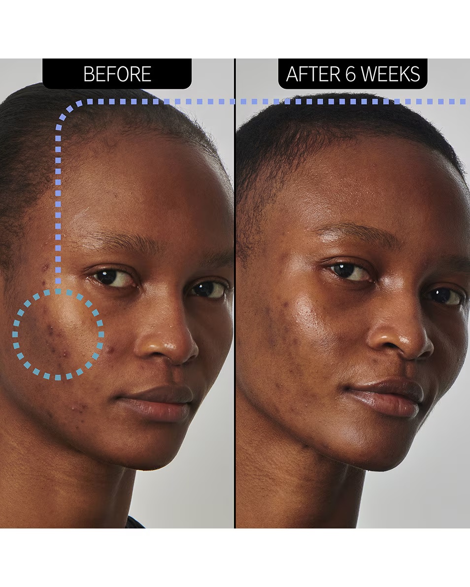 The Inkey List SUPERSOLUTIONS SUPERSOLUTIONS 20% NIACINAMID SERUM