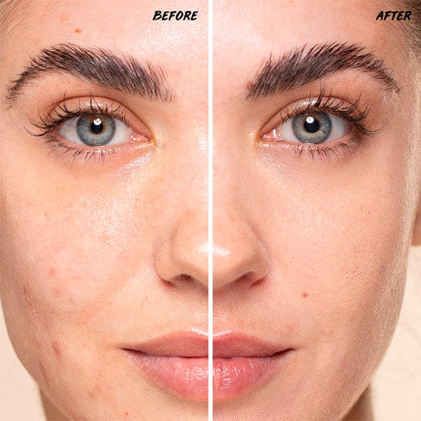 Vitamin Fix Concealer