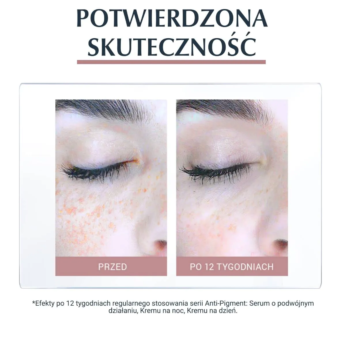 Eucerin Anti Pigment Krem na dzień SPF 30