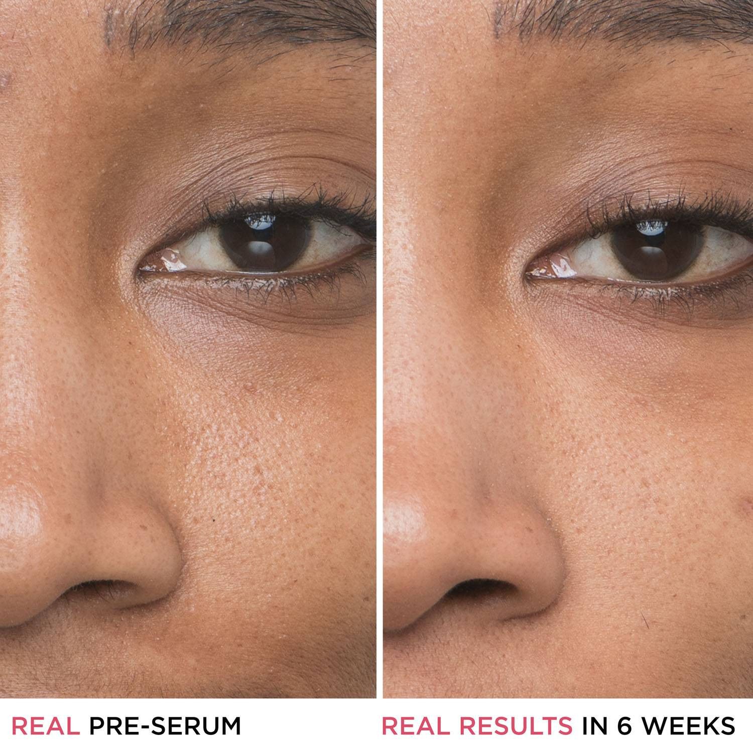 Serum za smanjenje pora lica Bye Bye Pores Luksuzni piling za lice