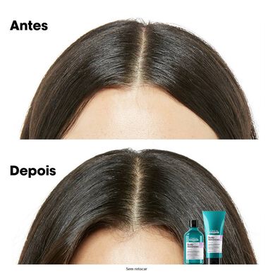 L'Oréal Professionnel Serie Expert Scalp Champú Avanzado Calmante para Cuero Cabelludo Sensible 500 ml 500 ml