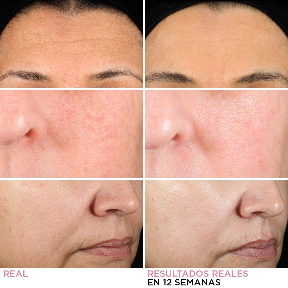 Krémové sérum s retinolom Hello Results Luxusné cielené ošetrenia