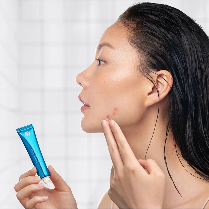 FOREO ESPADA™ BHA+PHA Blemish Solution aktuāls pūtītes gēls
