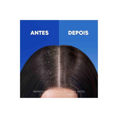 Head & Shoulders Classic Shampooing et après-shampooing antipelliculaire 2 en 1 300 ml