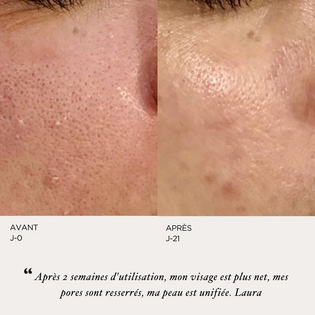ORYZA LAB Sérum perfecteur