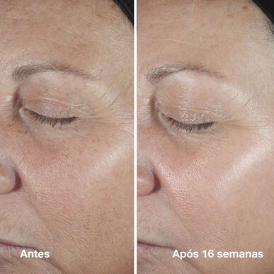Clinique Smart Clinical Repair Wrinkle Correcting Serum - Ikääntymistä ehkäisevä, kiinteyttävä ja hehkuttava seerumi