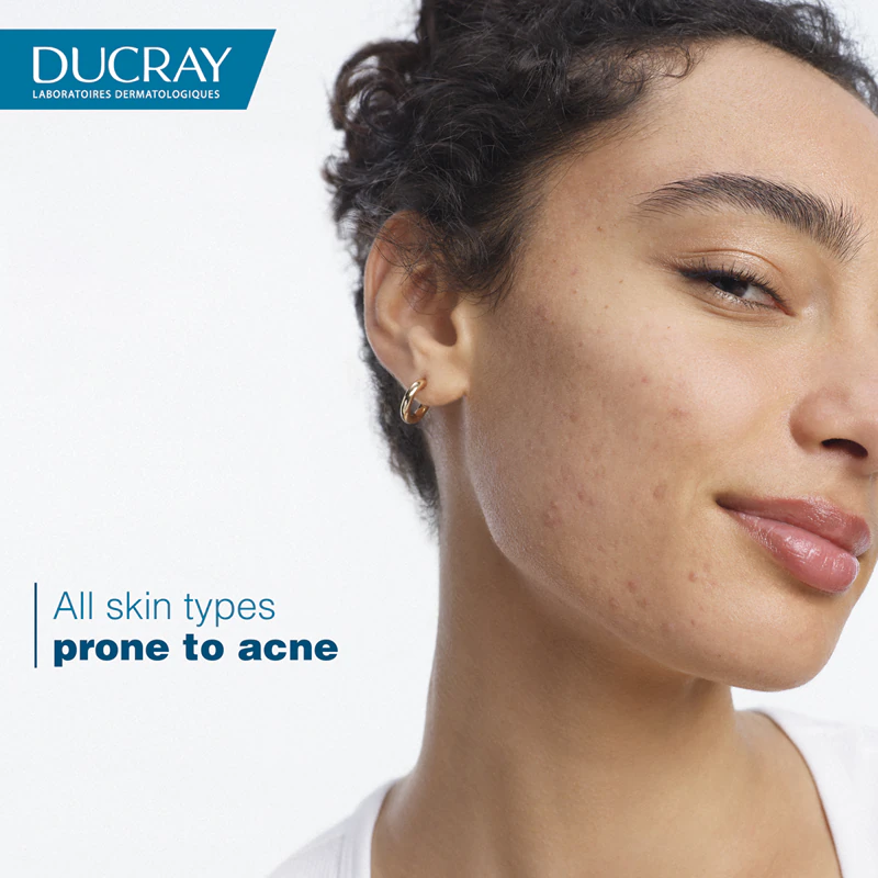 Ducray Keracnyl Gel espumante para pele oleosa e com tendência acneica