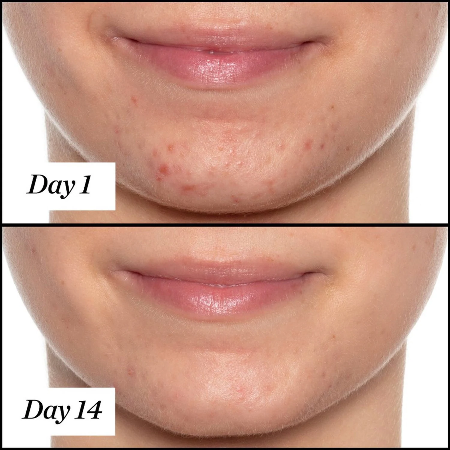 UFO - Ulei facial anti-imperfecțiuni