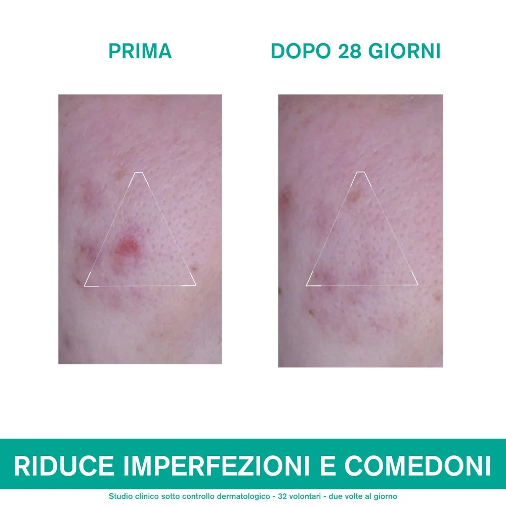 URIAGE Hyseac 3Regul+ 40ml rasusele nahale