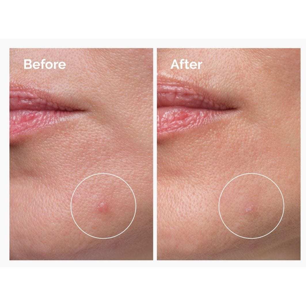 The Ordinary hidratantni serum sa sumporom 10% u obliku pudera i kreme - 5 g