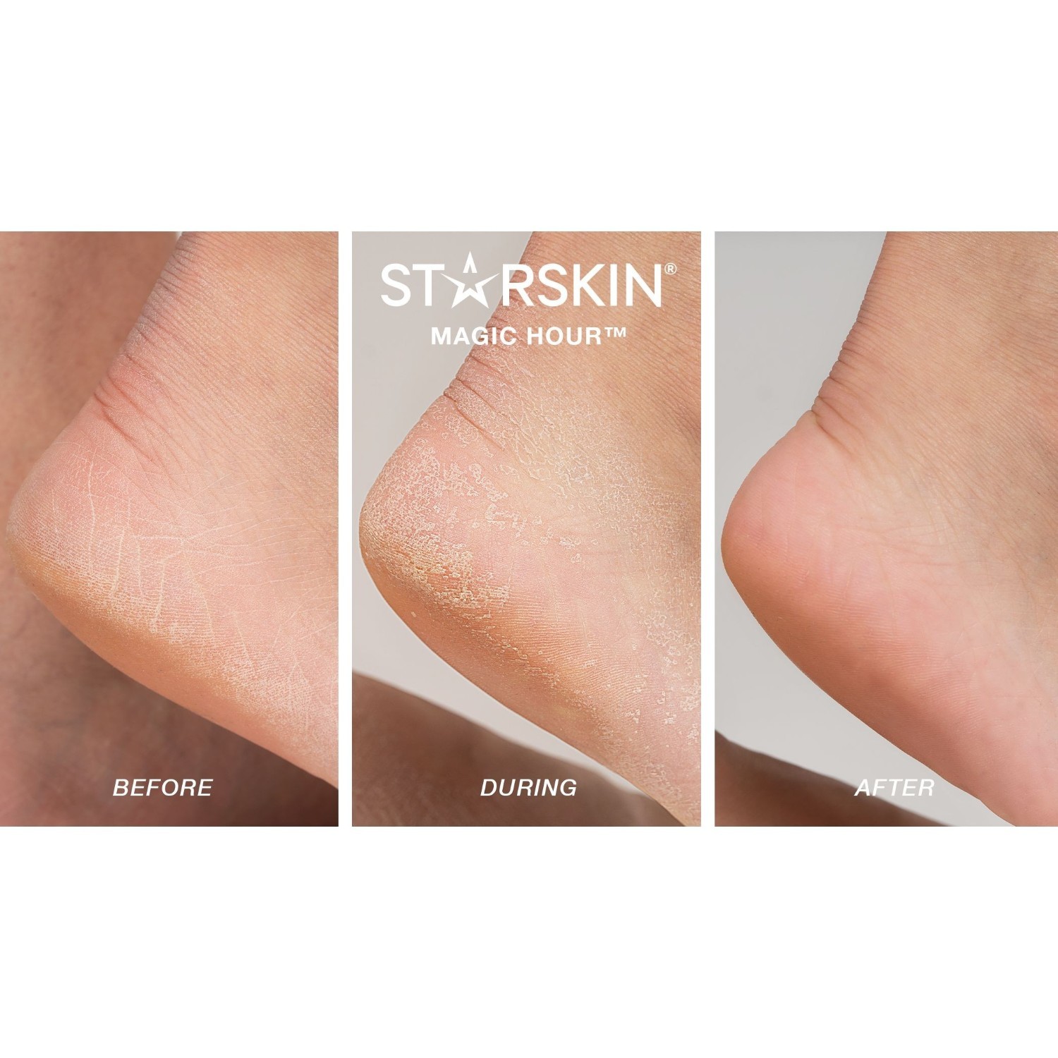 Pleťové masky STARSKIN® Magic Hour 3+1 balenie -