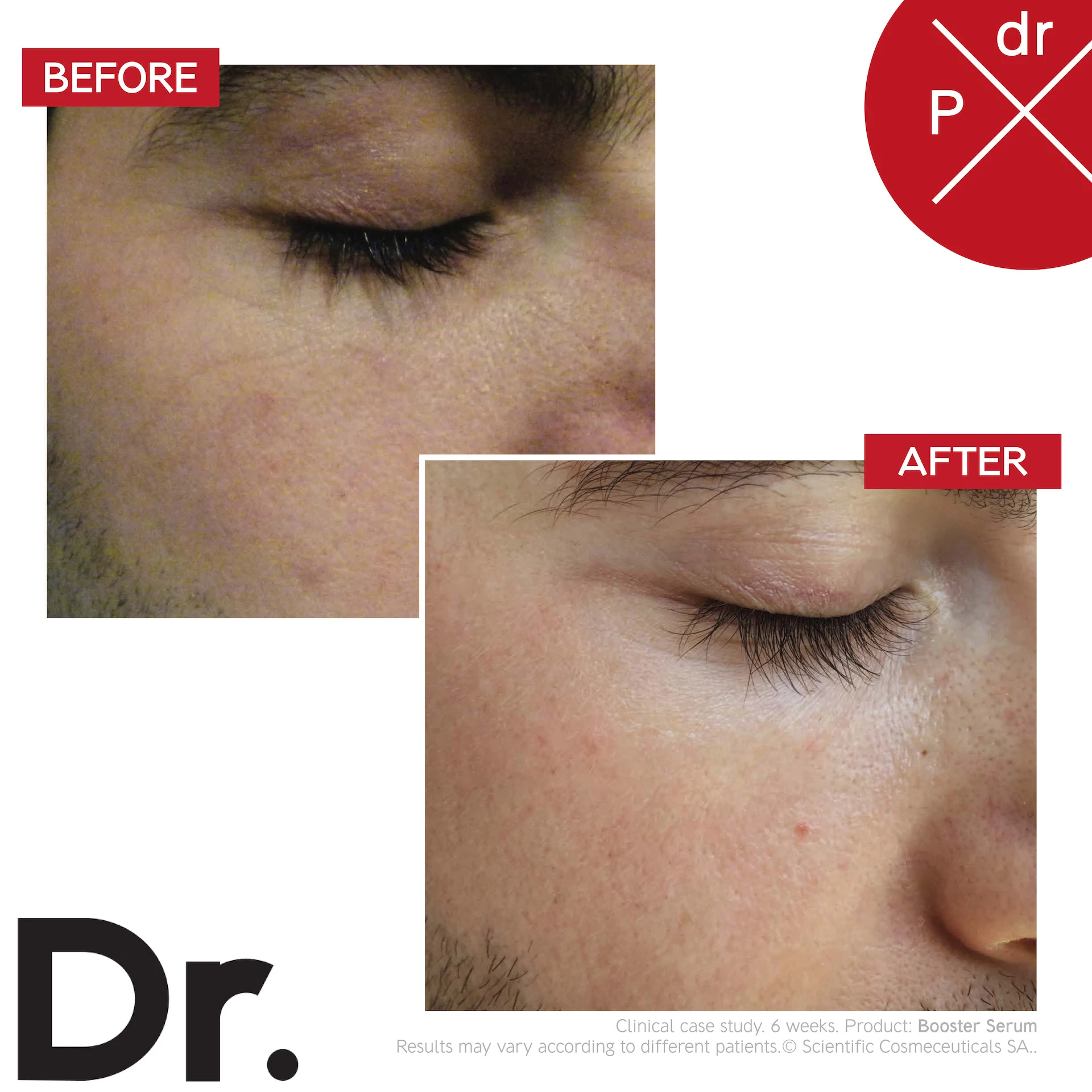 Serum za pojačavanje 30 ml - Dr LEVY Švicarska
