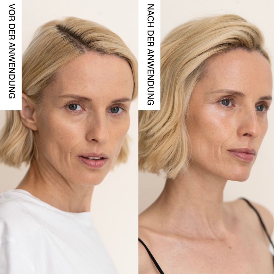 Elektrický masážny prístroj na tvár Rosental Organics s LED maskou na tvár – 1 kus