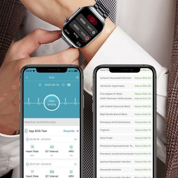 Reloj inteligente XtraDiTech con ECG, monitor de frecuencia cardíaca, VHR, termómetro, pantalla AMOLED de 2,04