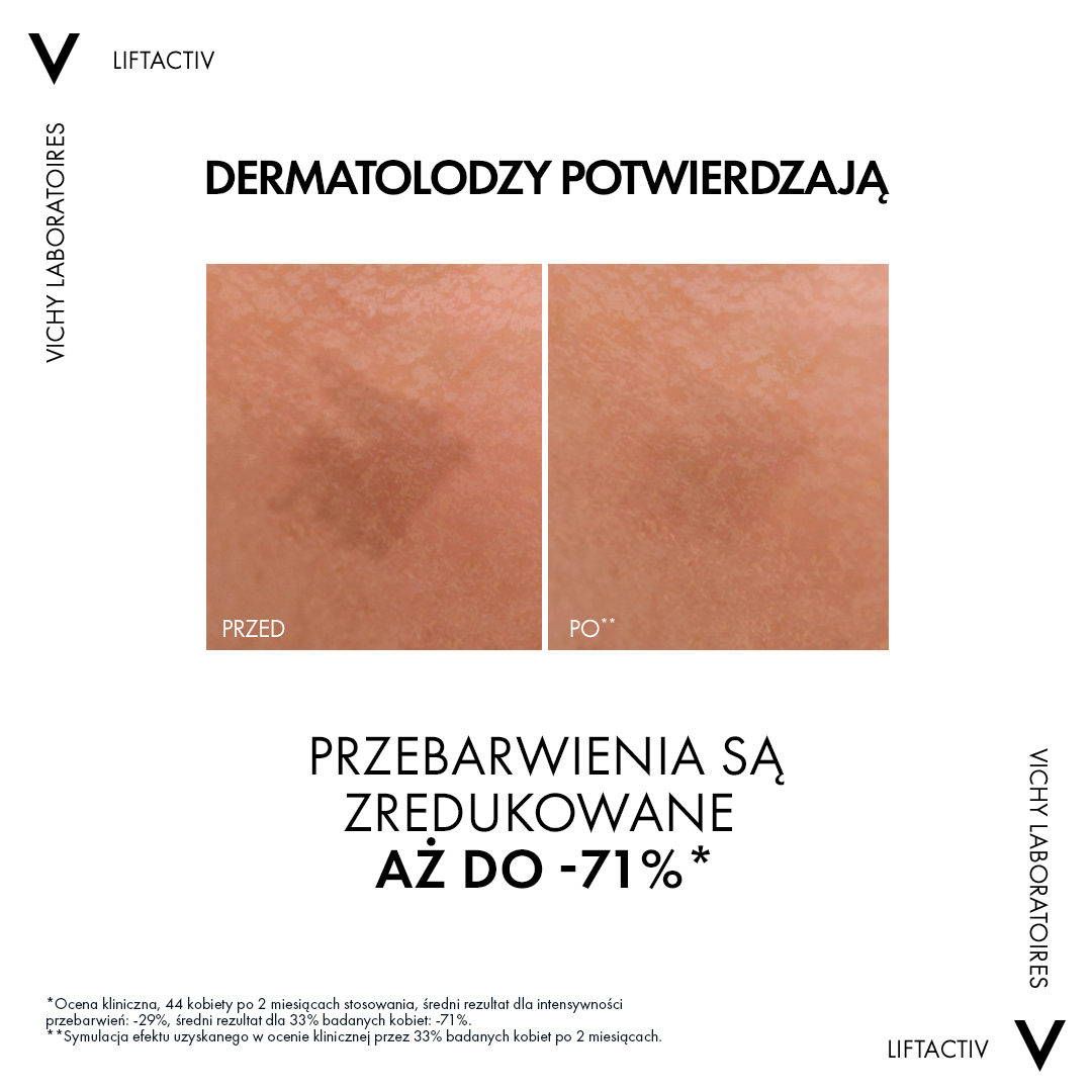 Vichy Liftactiv Specialist B3 szérum