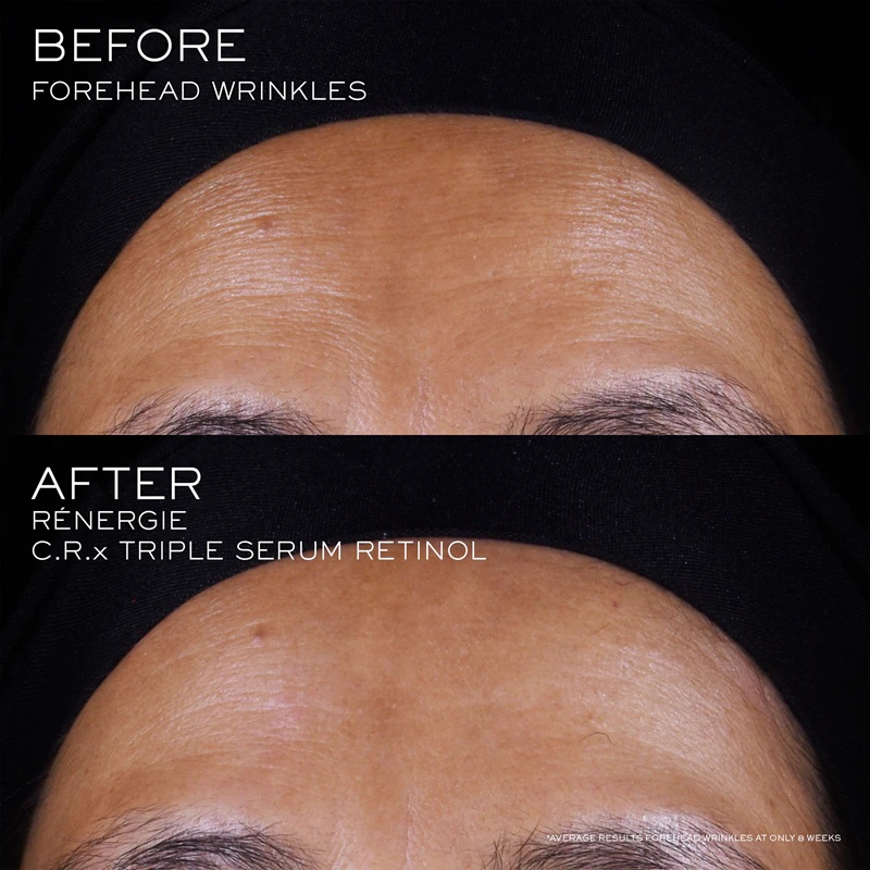 Lancôme Rénergie CRX Triple Serum серум за лице са ретинолом