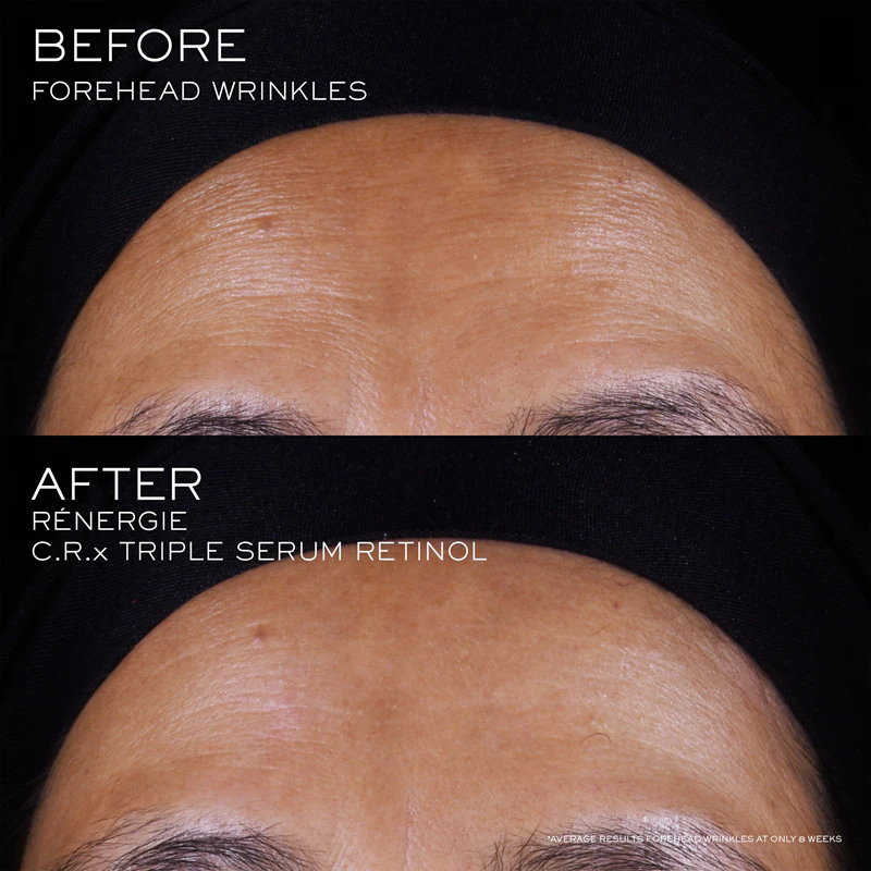 Lancôme Rénergie CRX Triple Serum Retinol gezichtsserum