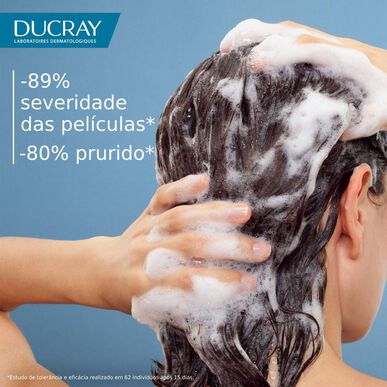 Ducray Kelual DS Treatment Shampoo Vakavaan Hilseen Rauhoittava Shampoo Poistaa Hilseen 100 ml 100 ml